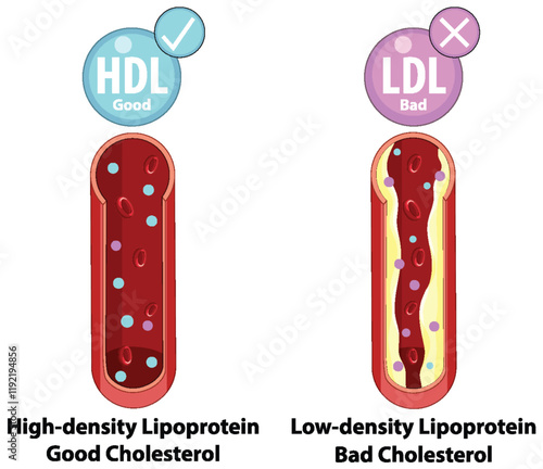 Cholesterol Types: HDL vs LDL