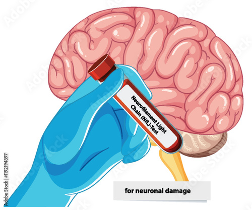 Medical Blood Test for Brain Health