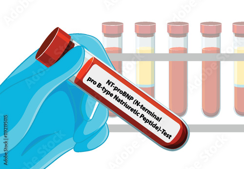 Medical Blood Test Illustration