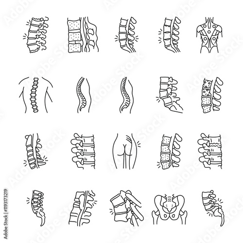 Diseases of the spine color line icons set.