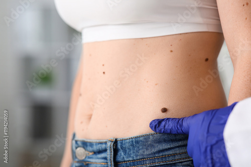 Dermatologist examining pat...