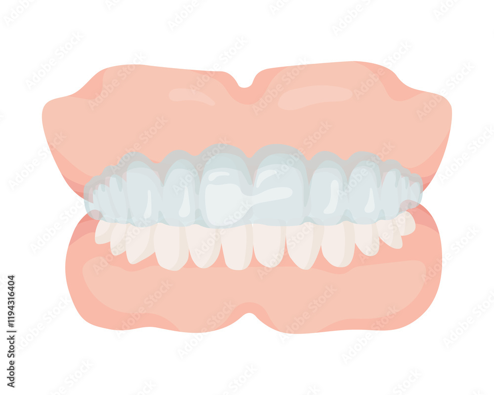 Fototapeta premium 歯科マウスピース