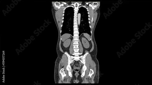 x-ray scan of front body by mri ct scan Internal Organs and Liver,Lungs,Intestines,Stomach,Bladder,Kidneys.