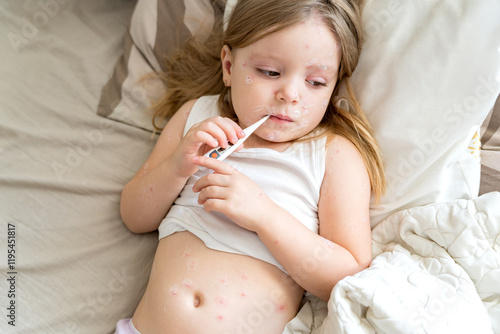 Obraz na plátně Fever, viral disease in a child
