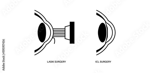 LASIK and ICL EVO
