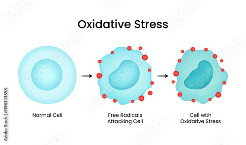 Mechanisms of Oxidative Stress Inflammation