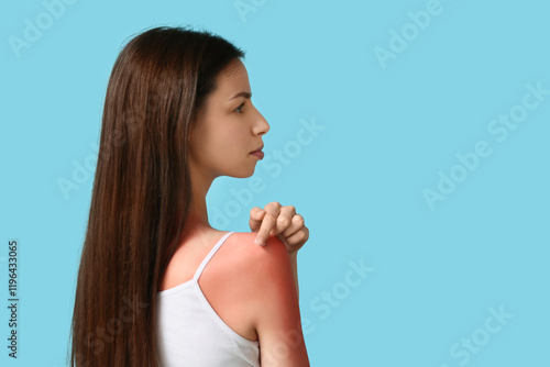 Allergic young woman with r...
