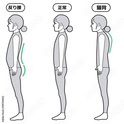 反り腰と猫背の状態
