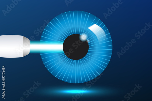 Eye with glaucoma, medical infographics with the anatomy of the human eye optics. Laser eye surgery LASIK