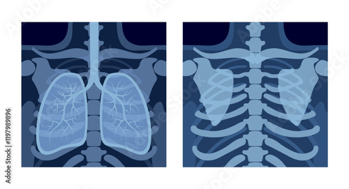 Cartoon-style X-rays of human lungs and chest. Vector illustration in cartoon flat style