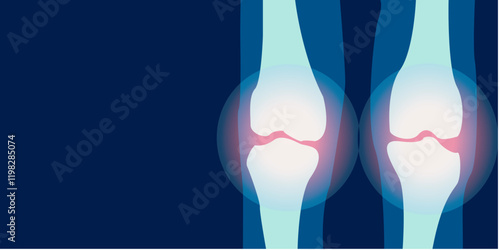 X-ray image of knee pain illustration. 2D illustration picture rontgen of leg bone. Vector design.