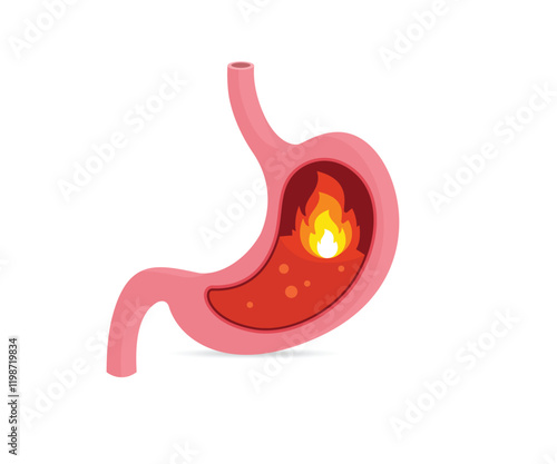 Heartburn in the stomach stock illustration