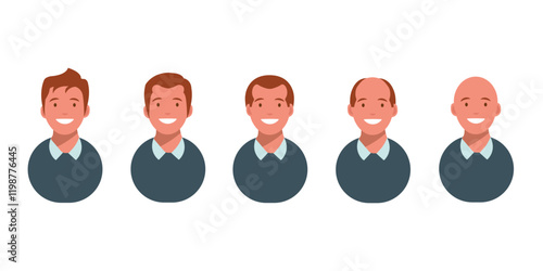 Male hair loss stages set. Top view portrait of a balding man. Baldness pattern scheme. Vector illustration.
