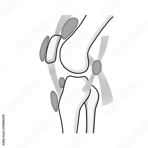 膝関節の骨と筋肉と滑液包をわかりやすく表したイラスト