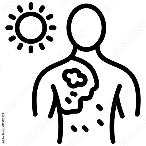 Sunburn Icon