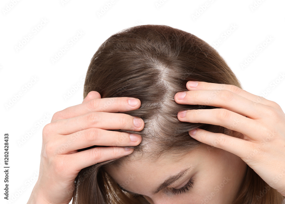 Girl with hair loss problem on white background, closeup Girl with hair loss problem on white background, closeup