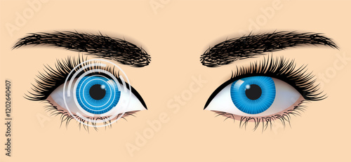 Laser eye surgery and glaucoma concept, close-up of eye with grid or target overlay