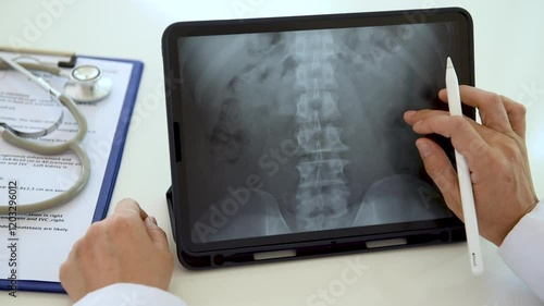 doctor radiologist diagnose spine lumber vertebrae x-ray image on digital tablet for diagnose Herniated disc disease.
