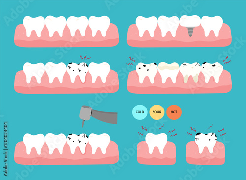 A set of teeth with various dental problems - caries, toothache, plaque, cracks, implant replacement, sensitivity. Vector hand-drawn illustration in flat style. Dental treatment, oral hygiene concept.
