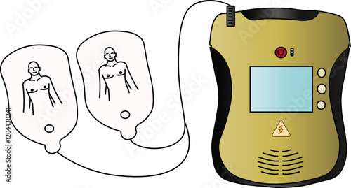 The Illustration of equipment called Automated External Defibrillator