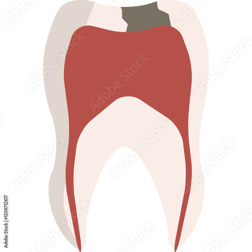 human tooth cavity