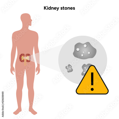 Human urine pain, diagnosis of ureter, kidney stones. Urologist medical disease	