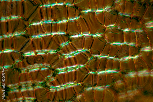 Annular fibrils in the cells of a Sphagnum branch leaf. photo