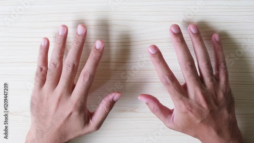 Top down view of person hands suffering tremor disorder