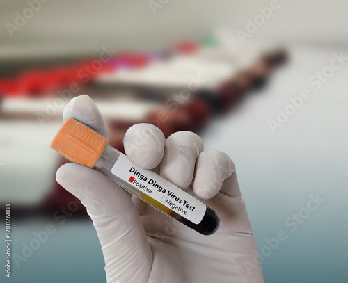 Doctor hold Blood sample for Lymphogranuloma Venereum (LGV) disease diagnosis test. HealthCare and medical concept. photo