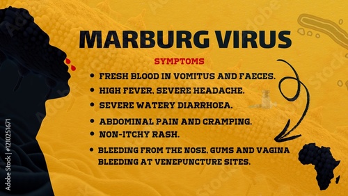 Symptoms of Marburg virus disease, Marburg virus disease (MVD), formerly known as Marburg haemorrhagic fever, is a severe, often fatal illness in humans. photo