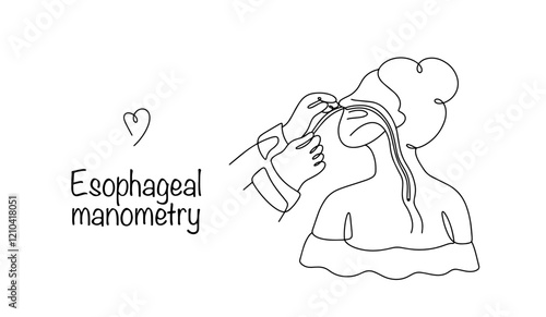 Esophageal manometry