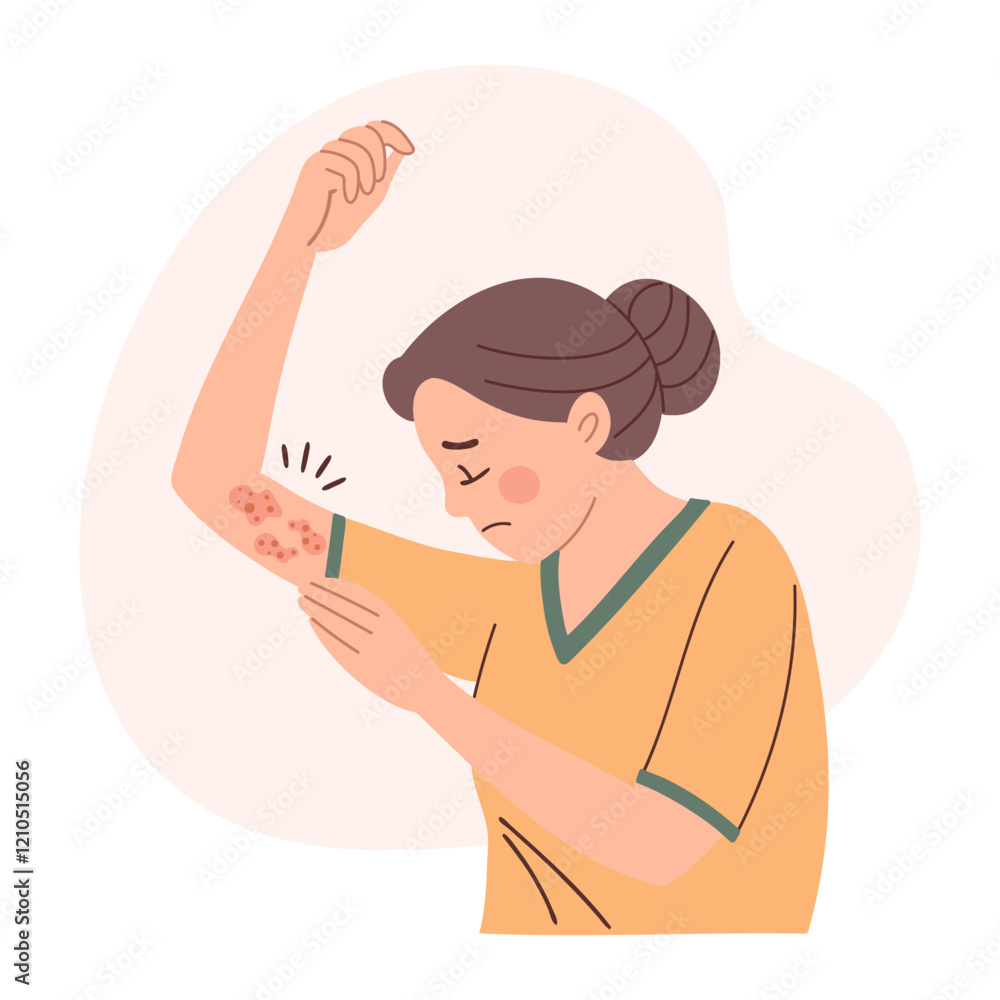 Woman with itchy skin rash. Allergic itching, skin inflammation, redness and irritation. Healthcare and medicine. Woman with itchy skin rash. Allergic itching, skin inflammation, redness and irritation. Healthcare and medicine.