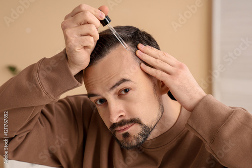 Handsome man applying serum for hair growth in bathroom, closeup photo