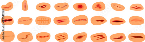 Bloody wounds icons set. Set of various wounds, illustrating different levels of skin damage, including cuts, scratches, and stitched areas