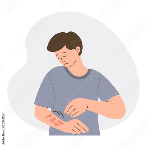 Man with itchy skin rash. Allergic itching, skin inflammation, redness and irritation. Healthcare and medicine.