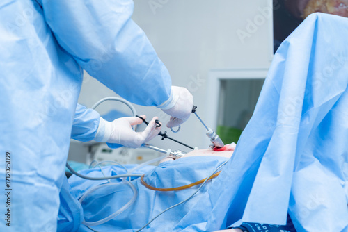 abdominal surgery, laparoscopy, cholecystectomy, removal of the gallbladder using an endoscope and laparoscope, hospital, operating room, patient under anesthesia, doctors
