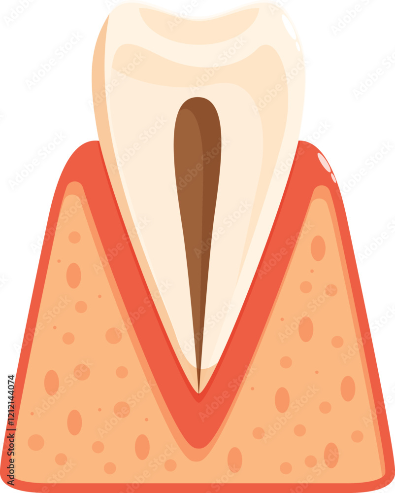 Dental cross section showing receding gums, periodontitis, and tooth decay affecting dentin and pulp Dental cross section showing receding gums, periodontitis, and tooth decay affecting dentin and pulp