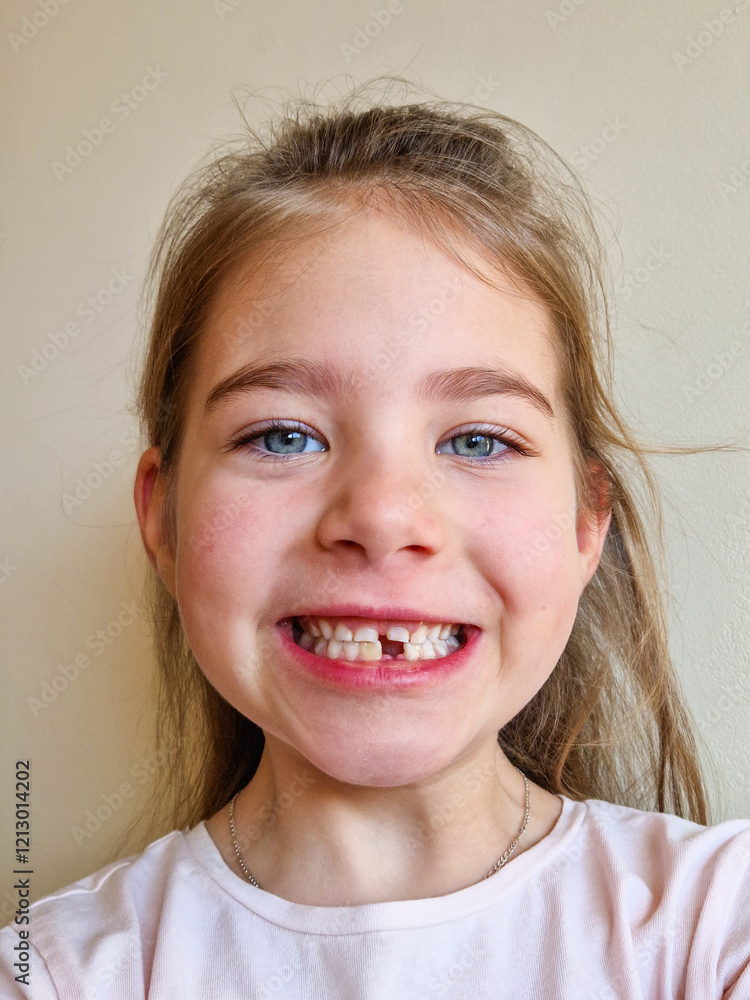 Child Smiling with a Missing Tooth Child Smiling with a Missing Tooth