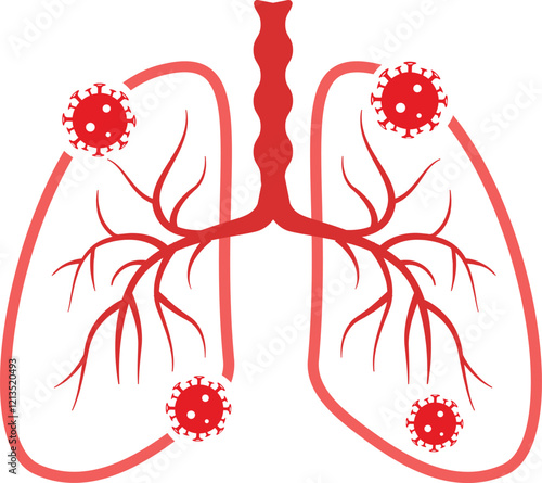 Human lungs Infected Virus Vector  Illustration