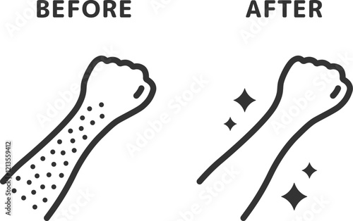 腕脱毛の、ビフォーアフターのアイコン（線画）のイラスト