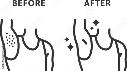 ワキ脱毛の、ビフォーアフターのアイコン（線画）のイラスト