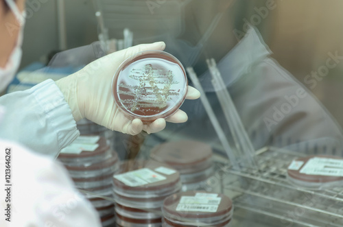 Scientist examining a petri dish with bacterial cultures in a laboratory environment. Gonorrhea cultures are essential for antimicrobial susceptibility testing, guiding effective treatment options. photo