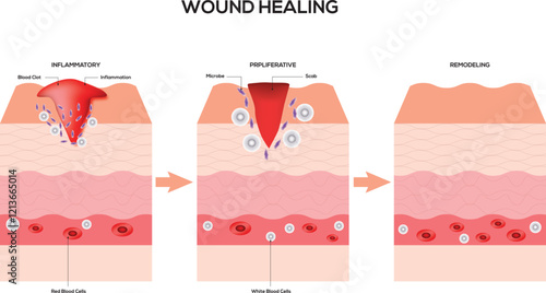 Wound Healing Science Design Vector Illustration Diagram