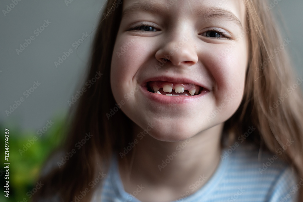 Smiling caucasian young girl with missing teeth in striped shirt Smiling caucasian young girl with missing teeth in striped shirt