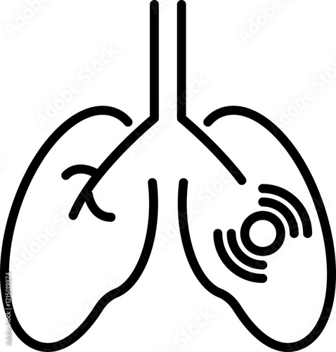 Inflammatory Lung Diseases