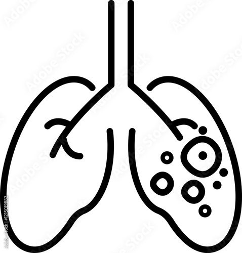 Inflammatory Lung Diseases