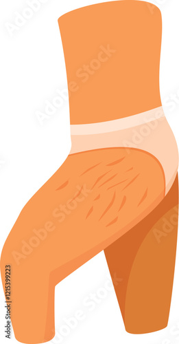 Woman with cellulite on her thighs and buttocks, body positive concept promoting self acceptance