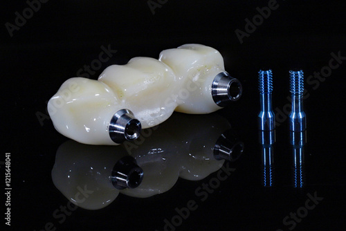 Konstfotografi Dental implant surgery and dental implant supported bridge prosthesis