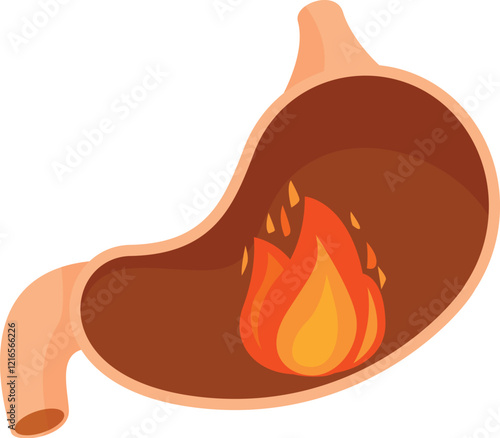 Stomach burning representing heartburn or gastritis symptom, digestive system disease