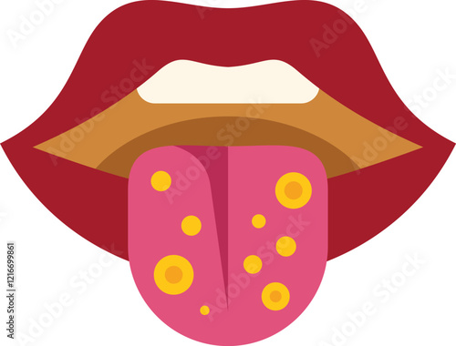 Woman showing her tongue with yellow spots representing oral thrush infection, close up view